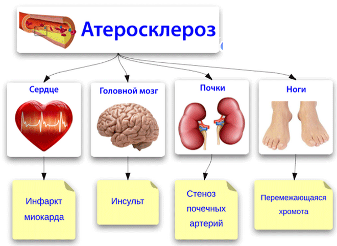Атеросклероз. Профилактика и лечение